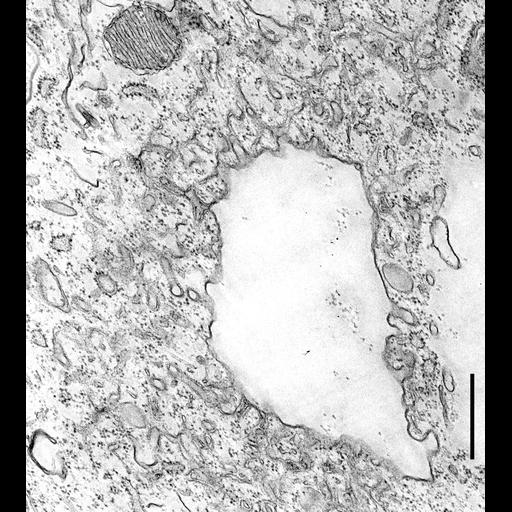  NCBI Organism:Coleps hirtus; Cell Types:, ; Cell Components:contractile vacuole, contractile vacuolar membrane, ; Biological process:water transport, response to water;