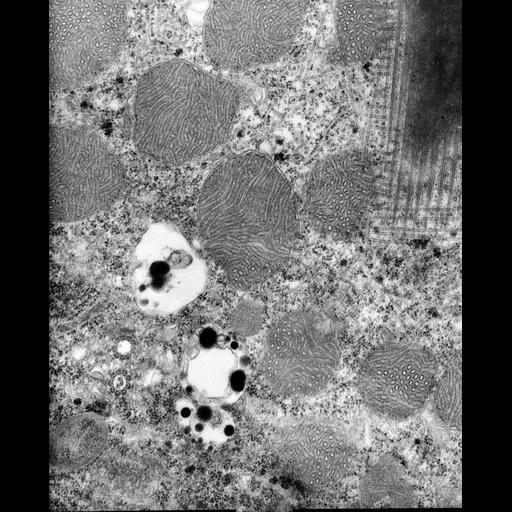  NCBI Organism:Euplotes sp.; Cell Types:cell by organism, eukaryotic cell, , ; Cell Components:microtubule basal body, cortical microtubule cytoskeleton, mitochondrial outer membrane, mitochondrial inner membrane, symbiont-containing vacuole; Biological process:cortical cytoskeleton organization, , ;