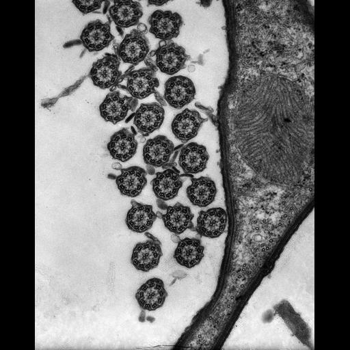  NCBI Organism:Euplotes sp.; Cell Types:cell by organism, eukaryotic cell, , ; Cell Components:cilium axoneme, axonemal microtubule, axonemal dynein complex, , plasma membrane, ; Biological process:cilium movement, ciliary or flagellar motility, ciliary cell motility;