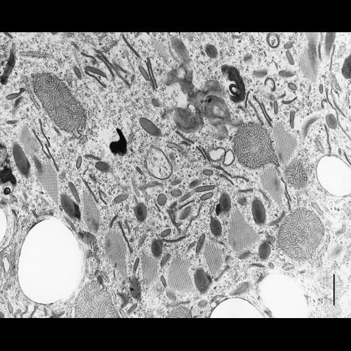  NCBI Organism:Coleps hirtus; Cell Types:eukaryotic cell, , ; Cell Components:oral apparatus, microtubule associated complex, ; Biological process:, digestion;