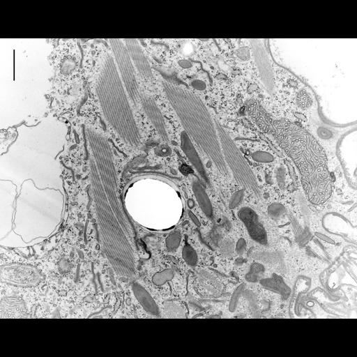  NCBI Organism:Coleps hirtus; Cell Types:eukaryotic cell, , ; Cell Components:cytoskeleton, microtubule cytoskeleton, actin cytoskeleton, bacteroid-containing symbiosome; Biological process:microtubule cytoskeleton organization, , detection of symbiont;