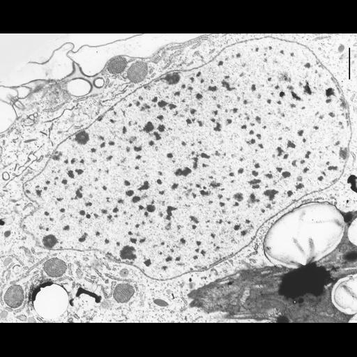  NCBI Organism:Coleps hirtus; Cell Types:eukaryotic cell, , ; Cell Components:macronucleus, nuclear pore, heterochromatin, nucleolus; Biological process:macronucleus organization, nuclear pore organization, chromatin organization, chromosome organization;