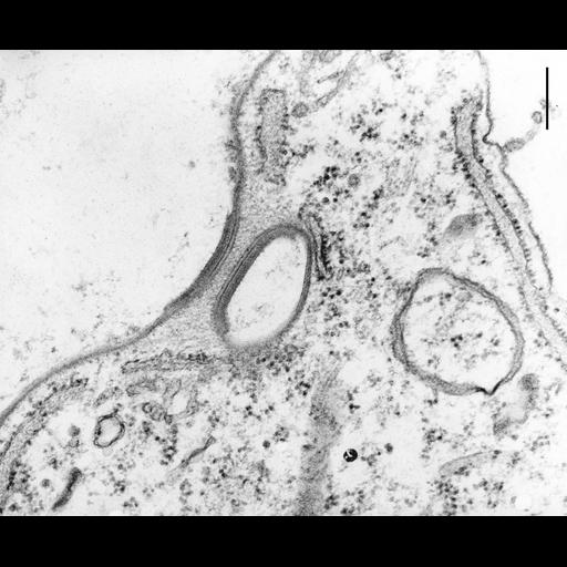  NCBI Organism:Coleps hirtus; Cell Types:eukaryotic cell, , ; Cell Components:plasma membrane, , rough endoplasmic reticulum membrane; Biological process:, calcium ion transport;