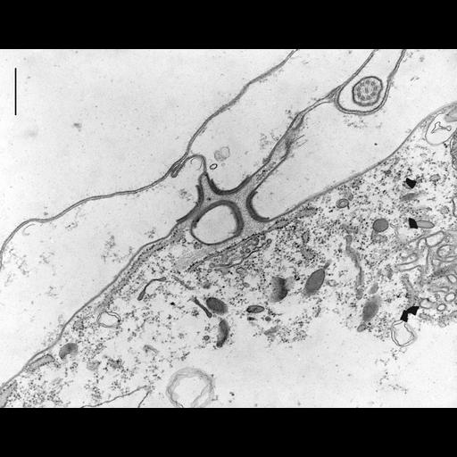  NCBI Organism:Coleps hirtus; Cell Types:eukaryotic cell, , ; Cell Components:plasma membrane, , Golgi apparatus, ; Biological process:, elevation of cytosolic calcium ion concentration;