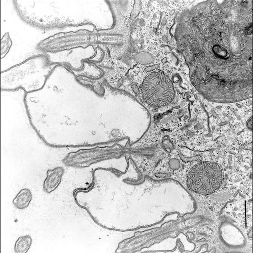  NCBI Organism:Coleps hirtus; Cell Types:eukaryotic cell, , ; Cell Components:cilium axoneme, axonemal microtubule, axonemal dynein complex, plasma membrane, microtubule basal body, cytoskeleton, microtubule cytoskeleton, actin cytoskeleton, food vacuole; Biological process:ciliary or flagellar motility, microtubule cytoskeleton organization, digestion;