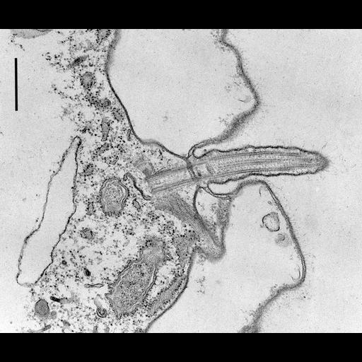  NCBI Organism:Coleps hirtus; Cell Types:eukaryotic cell, , ; Cell Components:cilium axoneme, axonemal microtubule, axonemal dynein complex, plasma membrane, microtubule basal body, cytoskeleton, microtubule cytoskeleton, actin cytoskeleton, bacteroid-containing symbiosome; Biological process:ciliary or flagellar motility, microtubule cytoskeleton organization, , detection of symbiont;