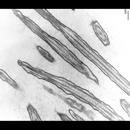  NCBI Organism:Coleps hirtus; Cell Types:eukaryotic cell, , ; Cell Components:cilium axoneme, axonemal microtubule, axonemal dynein complex, plasma membrane, microtubule basal body; Biological process:ciliary or flagellar motility, microtubule cytoskeleton organization;