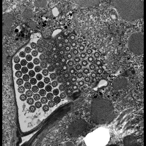  NCBI Organism:Euplotes sp.; Cell Types:cell by organism, eukaryotic cell, , ; Cell Components:cilium axoneme, axonemal microtubule, axonemal dynein complex, microtubule basal body, cytoplasmic microtubule, plasma membrane; Biological process:ciliary or flagellar motility, ciliary cell motility, cytoplasmic microtubule organization;