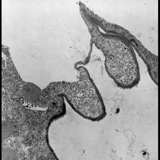  NCBI Organism:Euplotes sp.; Cell Types:cell by organism, eukaryotic cell, , ; Cell Components:contractile vacuole pore, contractile vacuole, microtubule, ; Biological process:water homeostasis, ;