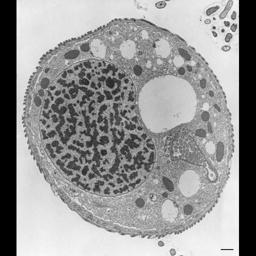  NCBI Organism:Opercularia [NCBITaxon:168247], , ; Cell Types:cell by organism, eukaryotic cell, , ; Cell Components:macronucleus, oral apparatus, mitochondrion, cell cortex, cytoplasm; Biological process:macronucleus organization, cortical cytoskeleton organization, cytoplasm organization;