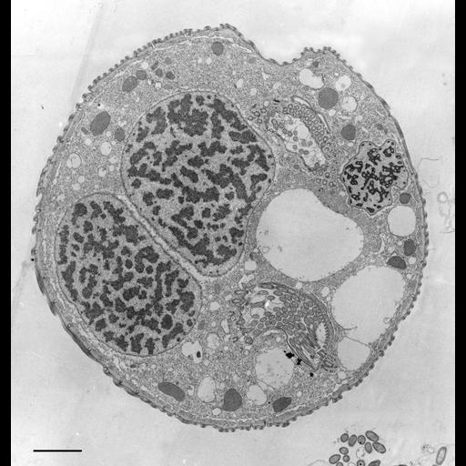  NCBI Organism:Opercularia [NCBITaxon:168247], , ; Cell Types:cell by organism, eukaryotic cell, , ; Cell Components:macronucleus, oral apparatus, mitochondrion, cell cortex, cytoplasm, contractile vacuole, micronucleus; Biological process:macronucleus organization, cortical cytoskeleton organization, cytoplasm organization, contractile vacuole organization, micronucleus organization;