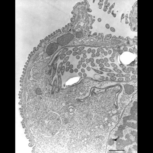  NCBI Organism:Opercularia [NCBITaxon:168247], , ; Cell Types:cell by organism, eukaryotic cell, , ; Cell Components:macronucleus, oral apparatus, contractile vacuole, cell cortex, cytoplasm; Biological process:macronucleus organization, cortical cytoskeleton organization, cytoplasm organization, contractile vacuole discharge;