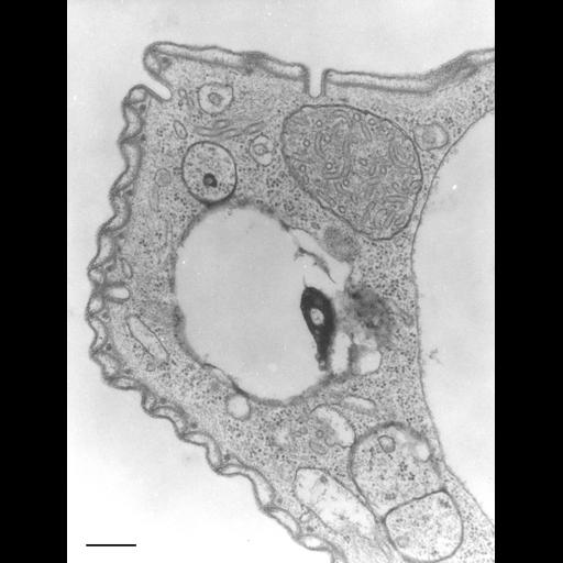  NCBI Organism:Opercularia [NCBITaxon:168247], , ; Cell Types:cell by organism, eukaryotic cell, , ; Cell Components:plasma membrane organization, clathrin coat of coated pit, , ; Biological process:plasma membrane organization, clathrin coat assembly, cytoskeletal anchoring at plasma membrane, ;