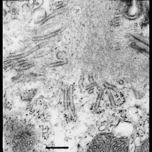  NCBI Organism:Opercularia [NCBITaxon:168247], , ; Cell Types:cell by organism, eukaryotic cell, , ; Cell Components:rough endoplasmic reticulum, myofibril; Biological process:calcium channel regulator activity, skeletal myofibril assembly;