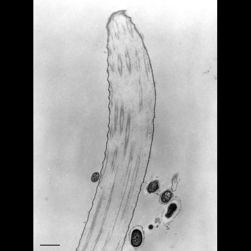  NCBI Organism:Opercularia [NCBITaxon:168247], , ; Cell Types:cell by organism, eukaryotic cell, , ; Cell Components:extracellular region, fibril; Biological process:fibril organization, ;