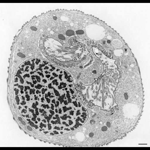  NCBI Organism:Opercularia [NCBITaxon:168247], , ; Cell Types:cell by organism, eukaryotic cell, , ; Cell Components:macronucleus, oral apparatus, mitochondrion, cell cortex, cytoplasm; Biological process:macronucleus organization, cortical cytoskeleton organization, cytoplasm organization, oral apparatus organization, nucleus organization;