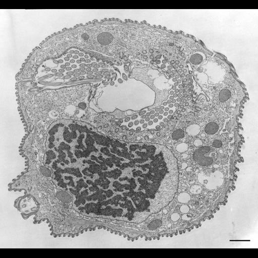  NCBI Organism:Opercularia [NCBITaxon:168247], , ; Cell Types:cell by organism, eukaryotic cell, , ; Cell Components:macronucleus, oral apparatus, cell cortex, cytoplasm; Biological process:macronucleus organization, cortical cytoskeleton organization, cytoplasm organization, oral apparatus organization;