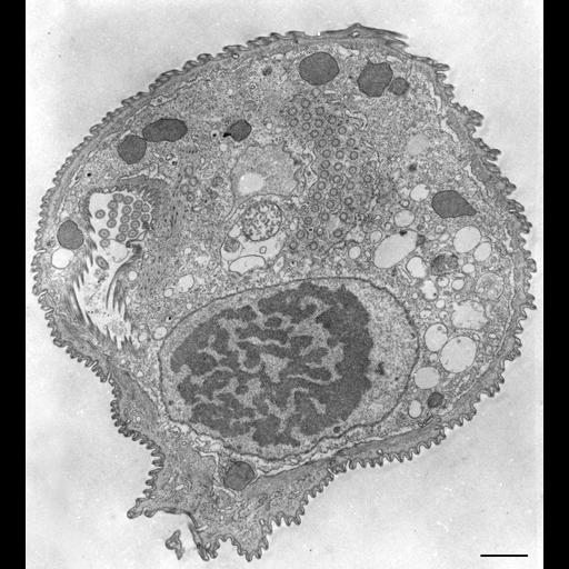  NCBI Organism:Opercularia [NCBITaxon:168247], , ; Cell Types:cell by organism, eukaryotic cell, , ; Cell Components:macronucleus, oral apparatus, cell cortex, cytoplasm, cytostome; Biological process:macronucleus organization, cortical cytoskeleton organization, cytoplasm organization, plasma membrane organization;