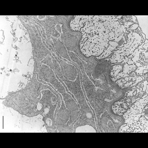  NCBI Organism:Nassula; Cell Types:cell by organism, eukaryotic cell, , ; Cell Components:endoplasmic reticulum membrane, plasma membrane, , ; Biological process:endoplasmic reticulum organization, , ;