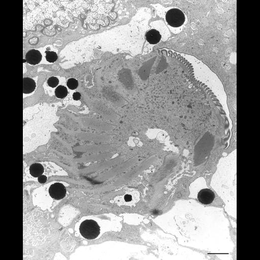  NCBI Organism:Nassula; Cell Types:cell by organism, eukaryotic cell, , ; Cell Components:oral apparatus, ; Biological process:oral apparatus organization, microtubule bundle formation;