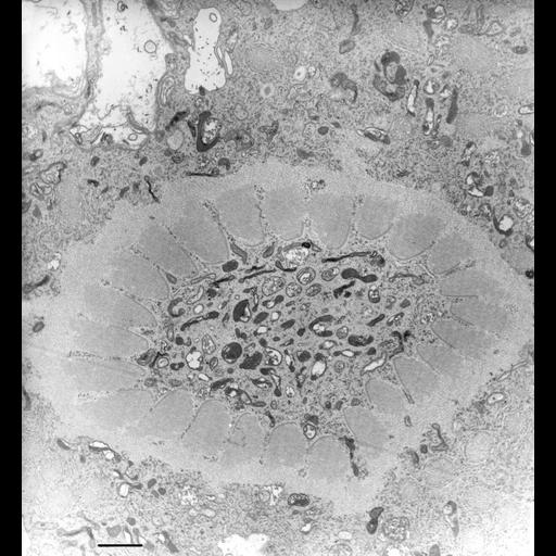  NCBI Organism:Nassula; Cell Types:cell by organism, eukaryotic cell, , ; Cell Components:oral apparatus, microtubule associated complex; Biological process:oral apparatus organization, microtubule bundle formation;