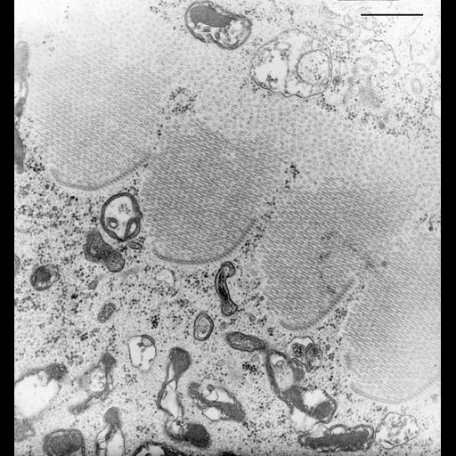  NCBI Organism:Nassula; Cell Types:cell by organism, eukaryotic cell, , ; Cell Components:oral apparatus, microtubule associated complex; Biological process:oral apparatus organization, microtubule bundle formation;