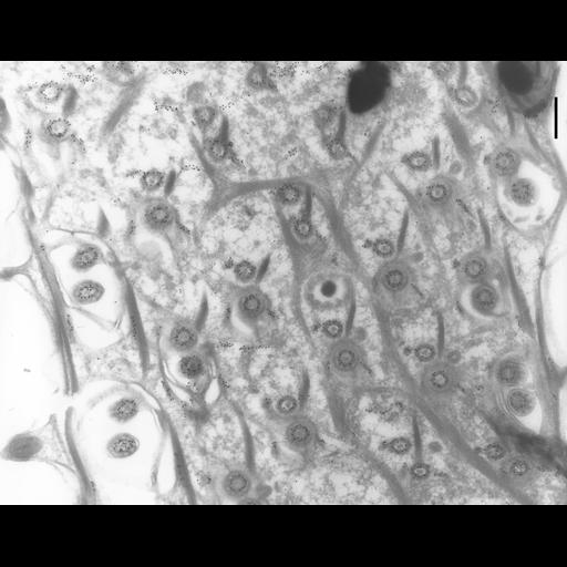  NCBI Organism:Paramecium tetraurelia; Cell Types:cell by organism, eukaryotic cell, , ; Cell Components:cell cortex, cortical microtubule cytoskeleton, cortical microtubule, microtubule basal body, axonemal microtubule; Biological process:microtubule cytoskeleton organization