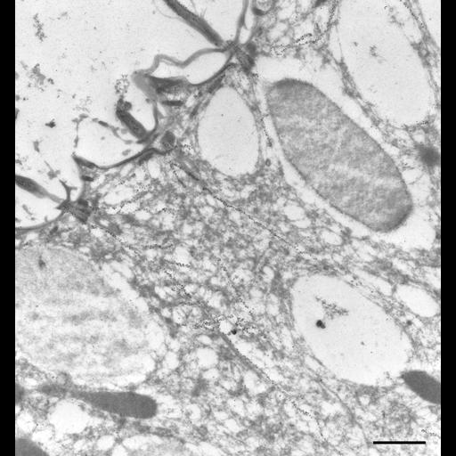  NCBI Organism:Paramecium tetraurelia; Cell Types:cell by organism, eukaryotic cell, , ; Cell Components:cell cortex, cortical microtubule cytoskeleton, cortical microtubule, trichocyst, microtubule basal body; Biological process:microtubule cytoskeleton organization, microtubule basal body organization, cortical cytoskeleton organization;