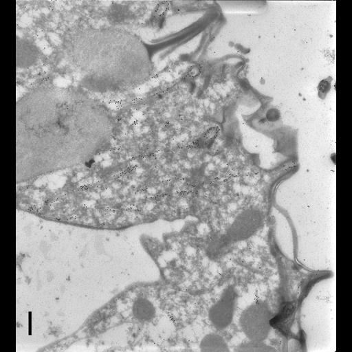  NCBI Organism:Paramecium tetraurelia; Cell Types:cell by organism, eukaryotic cell, , ; Cell Components:cell cortex, cortical microtubule cytoskeleton, cortical microtubule, cytoproct; Biological process:microtubule cytoskeleton organization