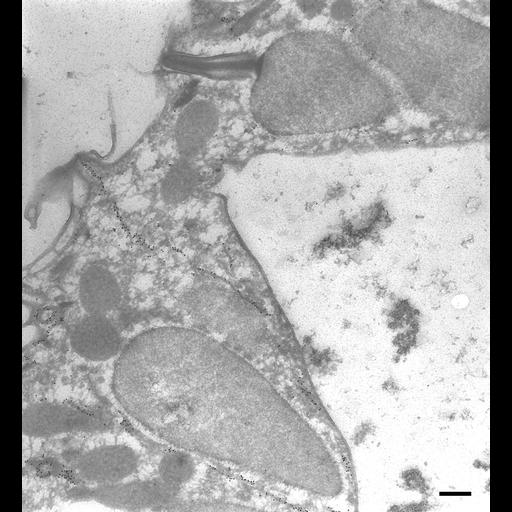  NCBI Organism:Paramecium tetraurelia; Cell Types:cell by organism, eukaryotic cell, , ; Cell Components:cell cortex, cytoproct, trichocyst, microtubule; Biological process:microtubule cytoskeleton organization, ;