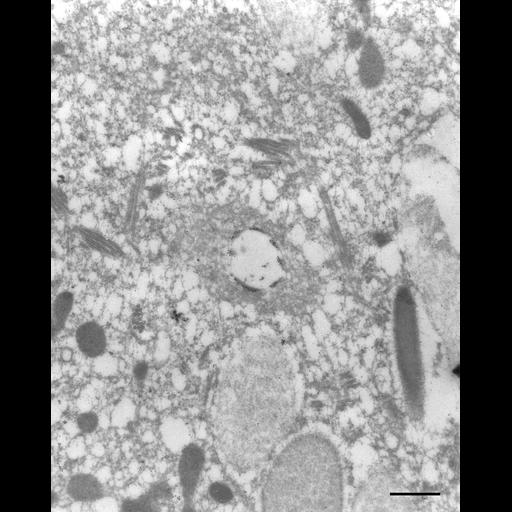  NCBI Organism:Paramecium tetraurelia; Cell Types:cell by organism, eukaryotic cell, , ; Cell Components:contractile vacuole, contractile vacuolar membrane, cytoplasmic microtubule; Biological process:contractile vacuole organization, cytoplasmic microtubule organization;