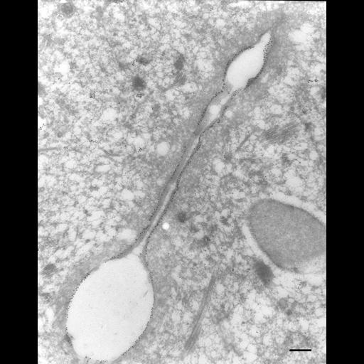  NCBI Organism:Paramecium tetraurelia; Cell Types:cell by organism, eukaryotic cell, , ; Cell Components:contractile vacuole, contractile vacuolar membrane, microtubule associated complex, ; Biological process:contractile vacuole organization, microtubule cytoskeleton organization;