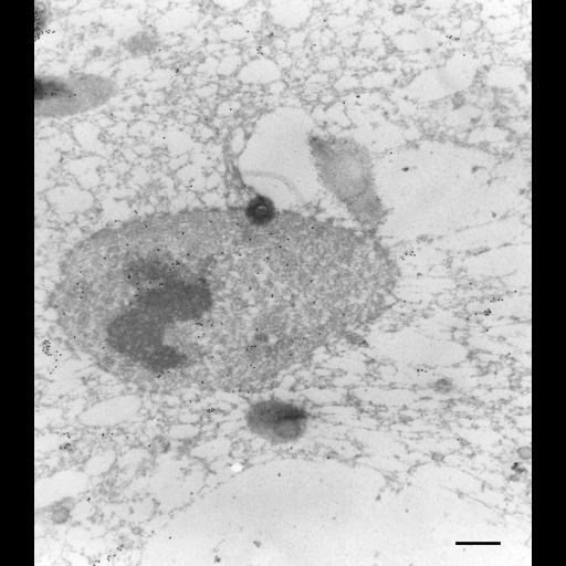  NCBI Organism:Paramecium tetraurelia; Cell Types:cell by organism, eukaryotic cell, , ; Cell Components:micronucleus, cytoplasmic microtubule, cytoplasm; Biological process:cytoplasm organization, micronucleus organization;