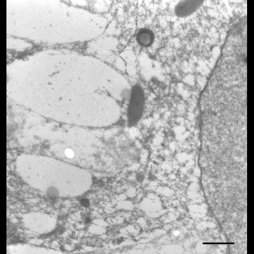  NCBI Organism:Paramecium tetraurelia; Cell Types:cell by organism, eukaryotic cell, , ; Cell Components:micronucleus, nuclear envelope, ; Biological process:micronucleus organization, nuclear division, ;