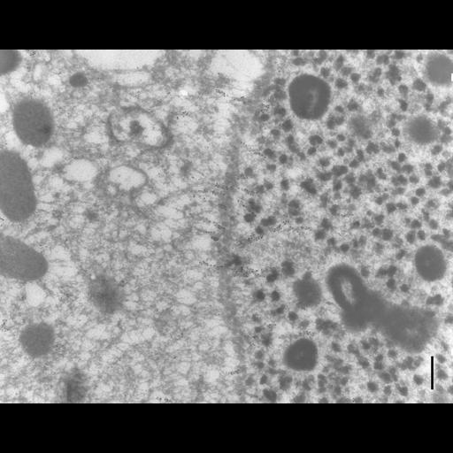  NCBI Organism:Paramecium tetraurelia; Cell Types:cell by organism, eukaryotic cell, , ; Cell Components:macronucleus, cytoplasmic microtubule, nuclear microtubule; Biological process:nuclear division, microtubule-based process, microtubule-based movement;