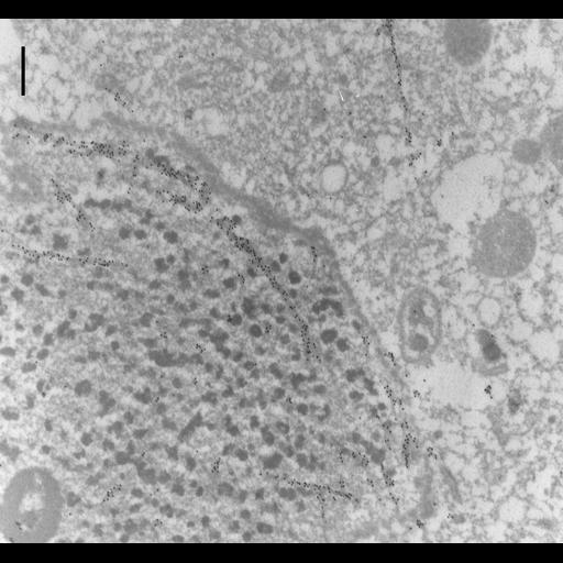  NCBI Organism:Paramecium tetraurelia; Cell Types:cell by organism, eukaryotic cell, , ; Cell Components:macronucleus, nuclear envelope, nuclear microtubule, cytoplasm; Biological process:nuclear division, macronucleus organization, microtubule-based process, microtubule-based movement;