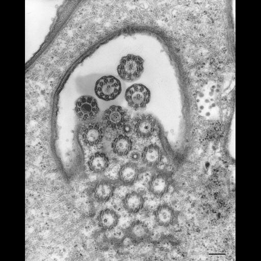  NCBI Organism:Euplotes sp.; Cell Types:cell by organism, eukaryotic cell, , ; Cell Components:cilium axoneme, axonemal microtubule, axonemal dynein complex, plasma membrane, ; Biological process:ciliary or flagellar motility, cilium movement, ;