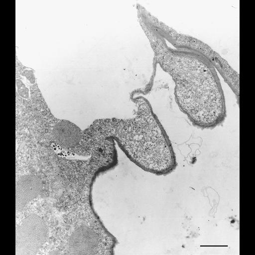  NCBI Organism:Euplotes sp.; Cell Types:cell by organism, eukaryotic cell, , ; Cell Components:contractile vacuole pore, contractile vacuole, contractile vacuolar membrane, microtubule; Biological process:water transport, water homeostasis, ;