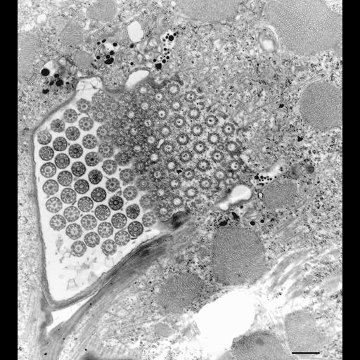  NCBI Organism:Euplotes sp.; Cell Types:cell by organism, eukaryotic cell, , ; Cell Components:cilium axoneme, axonemal microtubule, axonemal dynein complex, , plasma membrane; Biological process:ciliary or flagellar motility, cilium movement, ciliary cell motility, microtubule cytoskeleton organization, ;