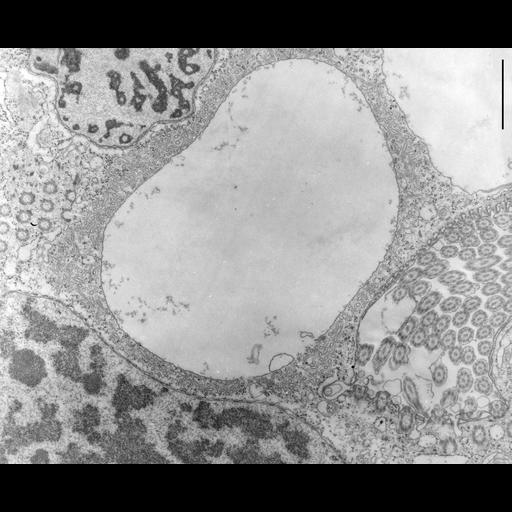  NCBI Organism:Opercularia [NCBITaxon:168247], , ; Cell Types:cell by organism, eukaryotic cell, , ; Cell Components:contractile vacuole, macronucleus, micronucleus, microtubule basal body; Biological process:, micronucleus organization;