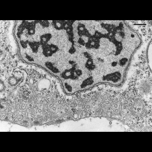  NCBI Organism:Opercularia [NCBITaxon:168247], , ; Cell Types:cell by organism, eukaryotic cell, , ; Cell Components:integral to contractile vacuolar membrane, smooth endoplasmic reticulum, , micronucleus; Biological process:water transport, , micronucleus organization;