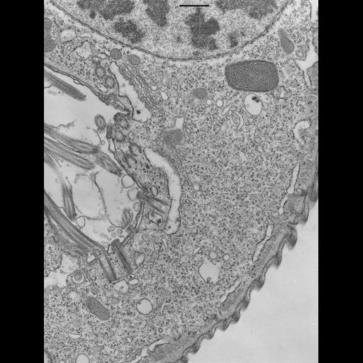  NCBI Organism:Opercularia [NCBITaxon:168247], , ; Cell Types:cell by organism, eukaryotic cell, , ; Cell Components:myofibril, macronucleus, Golgi stack; Biological process:cytoskeletal anchoring at plasma membrane, , Golgi organization, cytoplasm organization;