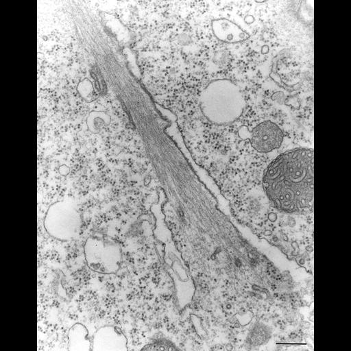  NCBI Organism:Opercularia [NCBITaxon:168247], , ; Cell Types:cell by organism, eukaryotic cell, , ; Cell Components:, rough endoplasmic reticulum, peroxisomal membrane, peroxisomal matrix, mitochondrial inner membrane; Biological process:, ;