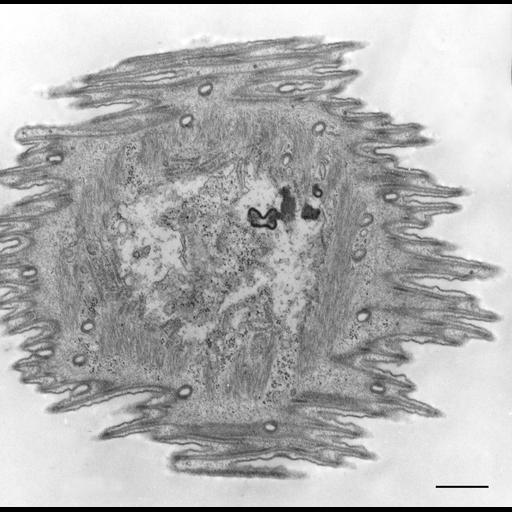  NCBI Organism:Opercularia [NCBITaxon:168247], , ; Cell Types:cell by organism, eukaryotic cell, , ; Cell Components:, smooth endoplasmic reticulum, clathrin coat of coated pit; Biological process:, ;