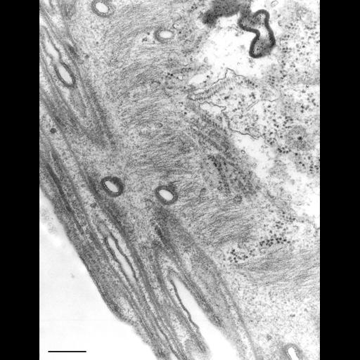  NCBI Organism:Opercularia [NCBITaxon:168247], , ; Cell Types:cell by organism, eukaryotic cell, , ; Cell Components:, ; Biological process:cytoskeleton organization, ;