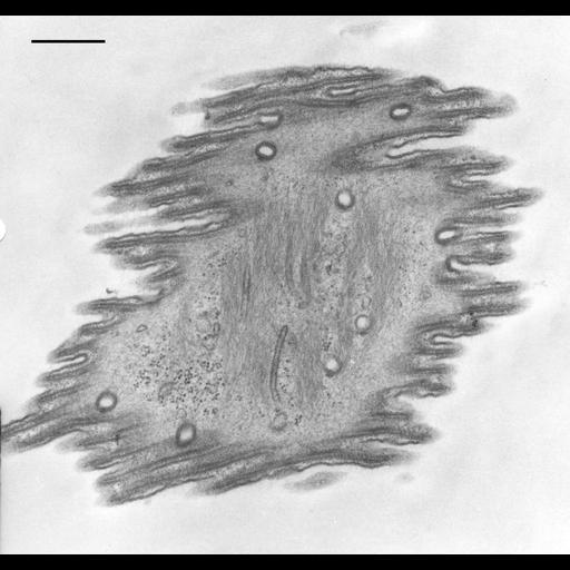  NCBI Organism:Opercularia [NCBITaxon:168247], , ; Cell Types:cell by organism, eukaryotic cell, , ; Cell Components:contractile fiber, rough endoplasmic reticulum, clathrin vesicle coat; Biological process:, ;