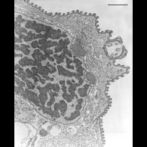  NCBI Organism:Opercularia [NCBITaxon:168247], , ; Cell Types:cell by organism, eukaryotic cell, , ; Cell Components:macronucleus, extracellular region, extracellular space, microtubule basal body; Biological process:cell adhesion, heterochromatin organization, chromosome organization;