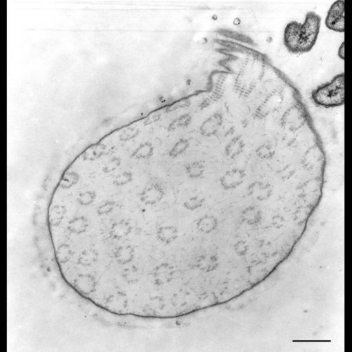  NCBI Organism:Opercularia [NCBITaxon:168247], , ; Cell Types:cell by organism, eukaryotic cell, , ; Cell Components:, extracellular matrix;