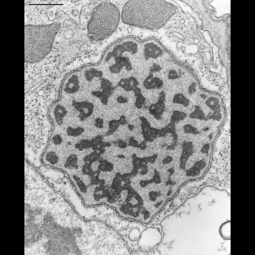  NCBI Organism:Opercularia [NCBITaxon:168247], , ; Cell Types:cell by organism, eukaryotic cell, , ; Cell Components:micronucleus, macronucleus, nuclear pore; Biological process:micronucleus organization, macronucleus organization, nucleocytoplasmic transport, ;