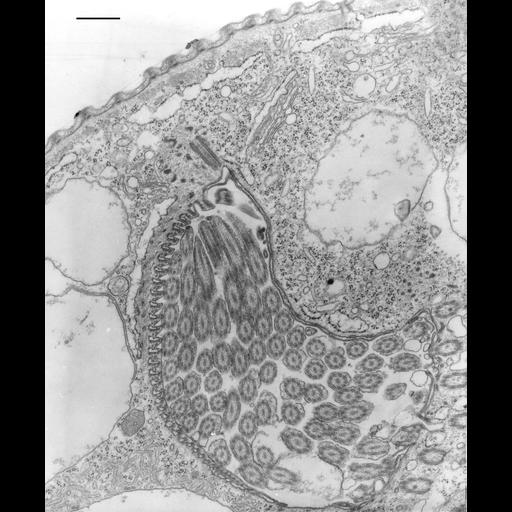  NCBI Organism:Opercularia [NCBITaxon:168247], , ; Cell Types:cell by organism, eukaryotic cell, , ; Cell Components:oral apparatus, contractile vacuole, microtubule basal body;